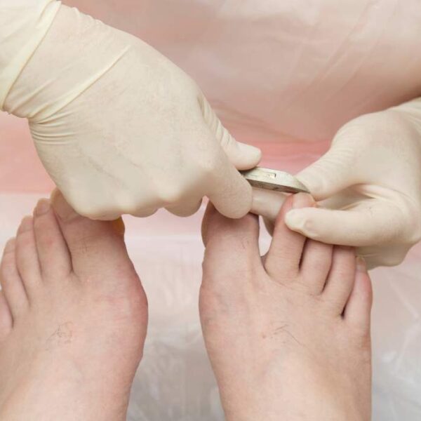 Consejos para cortar uñas de los pies a personas mayores