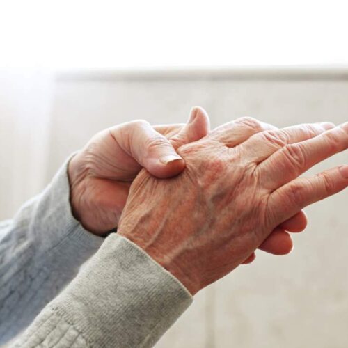 Artrosis en las manos