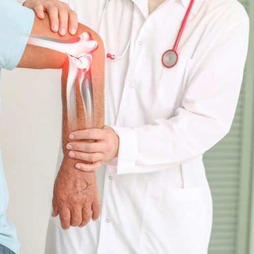 Húmero roto en personas mayores