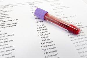 Cómo se diagnostica la insuficiencia renal en personas mayores