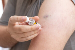 Preguntas frecuentes sobre hematomas sin golpes en ancianos